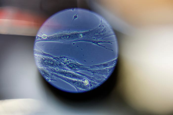 Blick ins Mikroskop: Vesikel sind Absonderungen von Zellen, die für Therapien genutzt werden ...