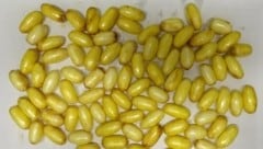 Der Verdächtige hatte Dutzende Päckchen in seinem Magen. 