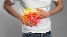 Wird ein Gallenstau nicht behandelt, kann dies zu schweren Leberschäden führen.