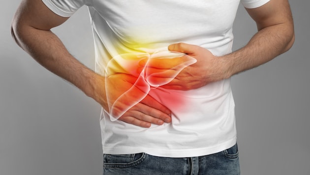 Wird ein Gallenstau nicht behandelt, kann dies zu schweren Leberschäden führen.