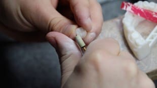 Was geschah wirklich im Zahntechnik-Labor? Das Gericht fand keine eindeutigen Beweise. ...