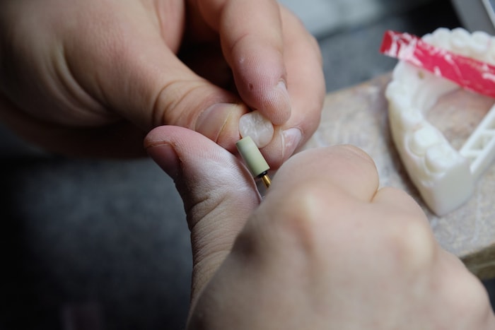 Was geschah wirklich im Zahntechnik-Labor? Das Gericht fand keine eindeutigen Beweise. ...