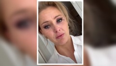 Patrice Aminati meldete sich mit einer bewegenden Nachricht bei ihren Fans. Sie spricht darin ...