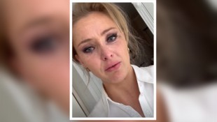 Patrice Aminati meldete sich mit einer bewegenden Nachricht bei ihren Fans. Sie spricht darin ...