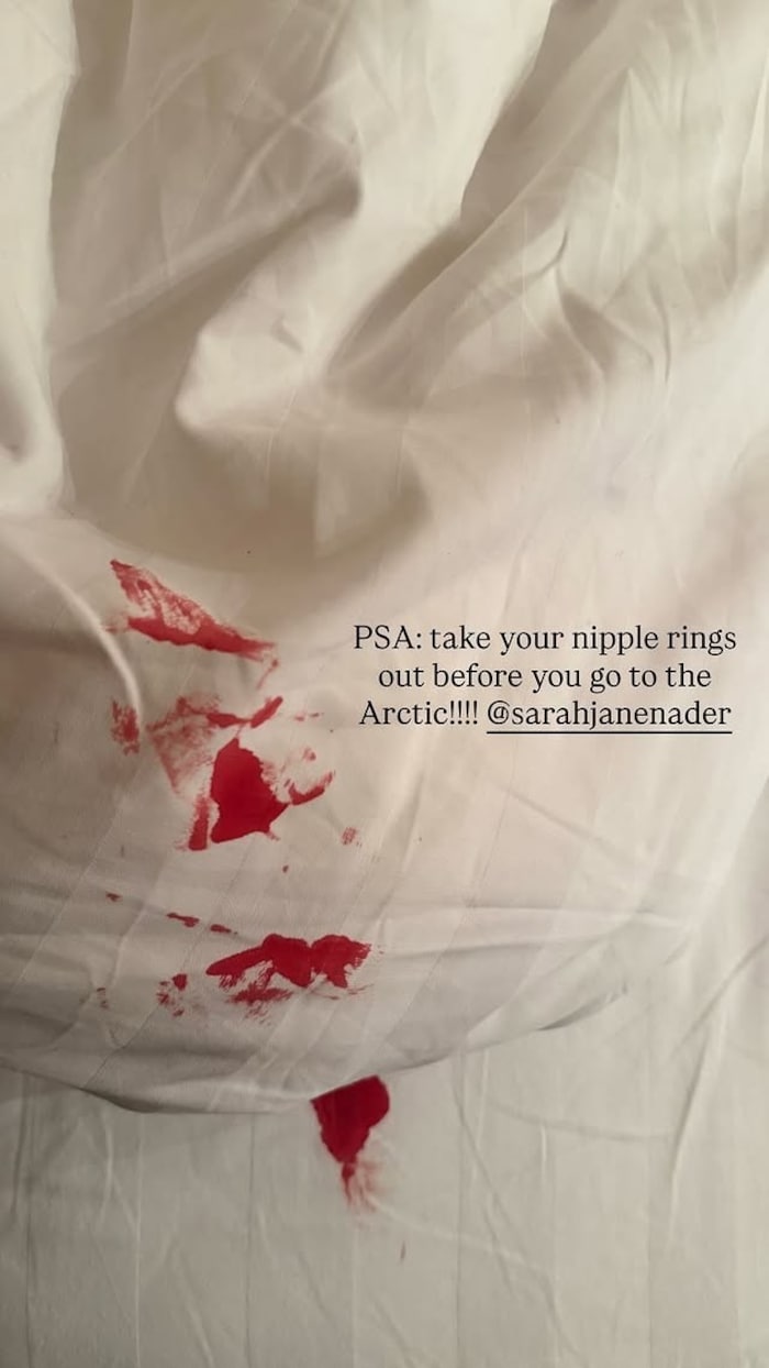 „PSA (Public Service Announcement – Öffentlicher Hinweis): Nehmt eure Nippelringe raus, bevor ...