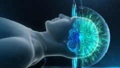 MRgFUS gegen das Zittern: Ultraschallwellen werden im Gehirn gezielt gebündelt.