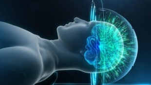 MRgFUS gegen das Zittern: Ultraschallwellen werden im Gehirn gezielt gebündelt.