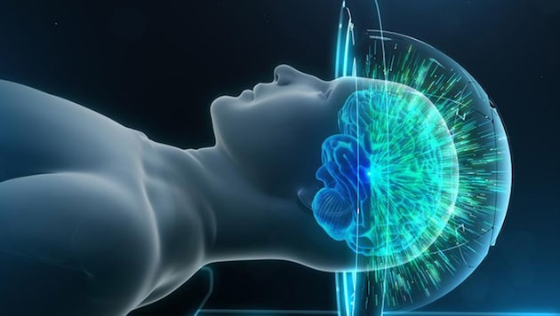 MRgFUS gegen das Zittern: Ultraschallwellen werden im Gehirn gezielt gebündelt.