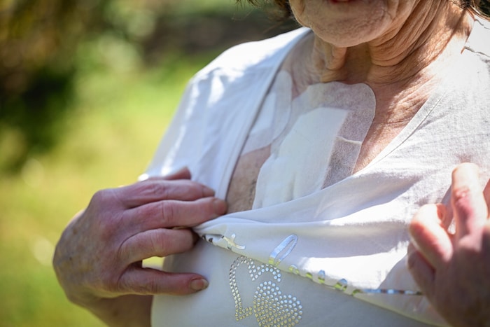Die Narben werden sie immer an ihre OP erinnern.