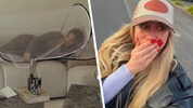 In ihrer Wohnung sind rund 200 Nosferatu‑Spinnen geschlüpft – die Influencerin lebt  aus Angst ...