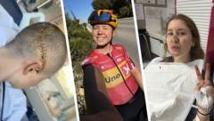 Kamilla Aasebø – links mit Riesennaht am Kopf, mittig Wochen vor dem Sturz in gesundem Zustand ...