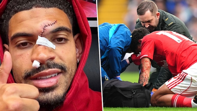 Morgan Gibbs-White zeigt seine Grusel-Narbe.