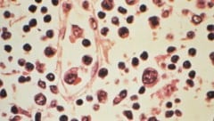 Eine Mikroskopaufnahme des Hantavirus