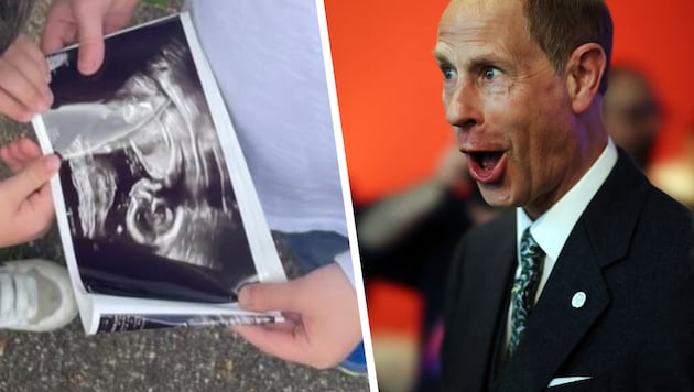 Royaler Tritt ins Protokoll: Das Baby auf dem Ultraschallbild kickt Prinz Edward frech auf Platz ...