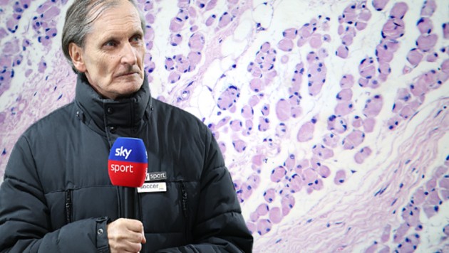 Alfred Tatar starb an ALS – siehe Darstellung oben unter dem Mikroskop: Muskelzellen, die von ...