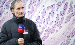 Alfred Tatar starb an ALS – siehe Darstellung oben unter dem Mikroskop: Muskelzellen, die von ...