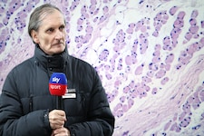 Alfred Tatar starb an ALS – siehe Darstellung oben unter dem Mikroskop: Muskelzellen, die von ...