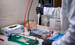 Acht der elf bestätigten Fälle sind Infektionen mit dem Andesvirus. (Symbolbild)