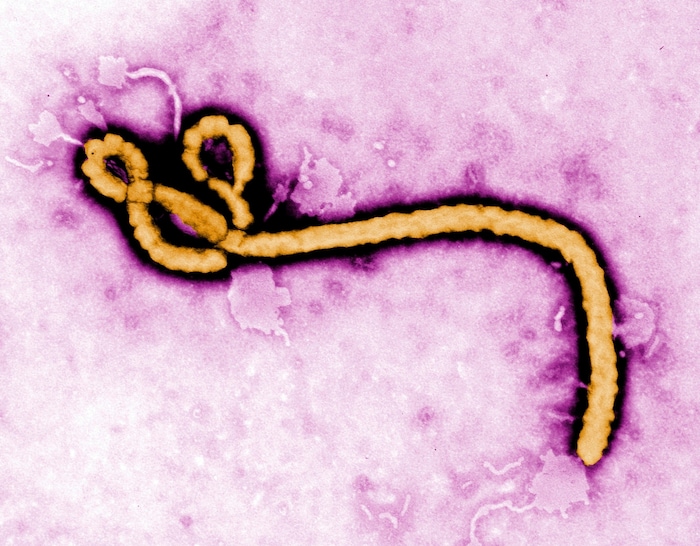 Das Ebola-Virus unter einem Elektronenmikroskop