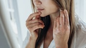 Patienten mit Psoriasisarthritis profitieren von der Kombitherapie.