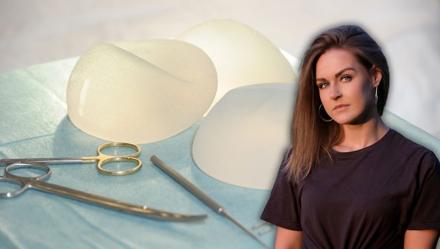 Sue Ann ließ sich Implantate einsetzen – ein großer Fehler, wie sich später herausstellte.