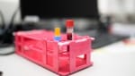 Mit einer kleinen Blutprobe kann im Labor analysiert werden, wie es um die Hormone steht.