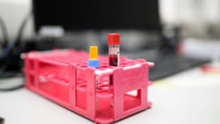 Mit einer kleinen Blutprobe kann im Labor analysiert werden, wie es um die Hormone steht.