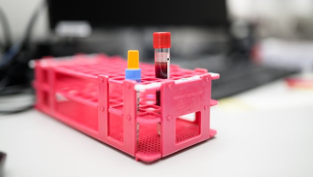 Mit einer kleinen Blutprobe kann im Labor analysiert werden, wie es um die Hormone steht.