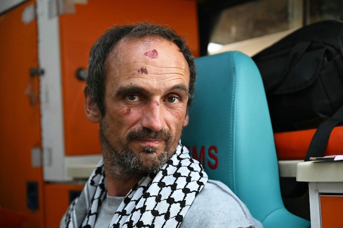 Ein Aktivist der Global Sumud Flotilla zeigt seine Verletzungen nach der Festnahme durch die ...