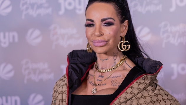 Gina-Lisa Lohfink kämpft mit den Folgen einer verpfuschten Po-OP aus der Türkei.