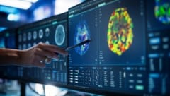 Eine Computertomographie-Aufnahme des menschlichen Rückenmarks
