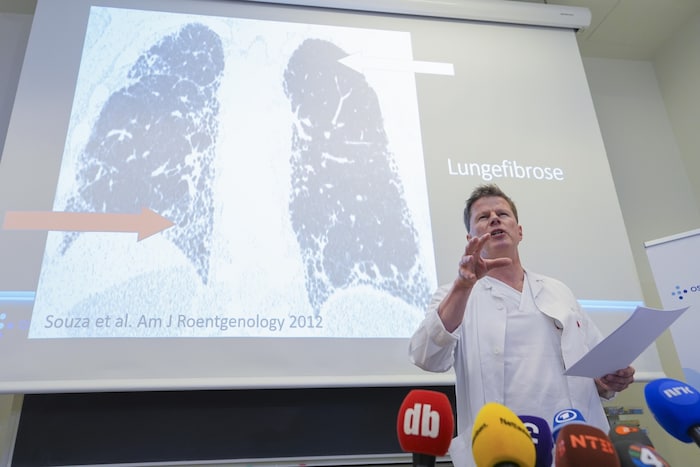 Are Holm erklärt, ab welchem Zeitpunkt bei einer Lungenfibrose nur noch eine Transplantation ...
