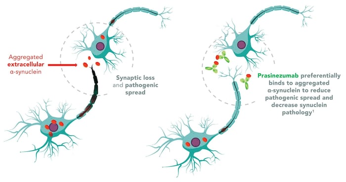 Prasinezumab (rechts in hellgrün) soll das Protein Alpha-Synuclein (rot) außerhalb der ...