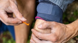 Das Virus zirkuliert offenbar bereits seit Jahrzehnten in Mitteleuropa. Weitere Forschung sei ...