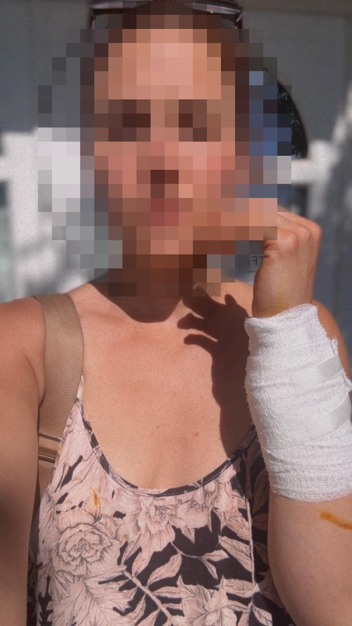Melanie wurde von dem Kater bereits zweimal in ihren eigenen vier Wänden attackiert.