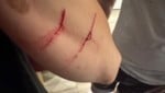 Seit Monaten dürfte der Kater in einer Siedlung in Korneuburg für Probleme sorgen. 