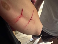 Seit Monaten dürfte der Kater in einer Siedlung in Korneuburg für Probleme sorgen. 