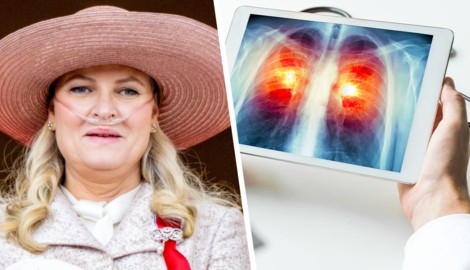 Die norwegische Kronprinzessin Mette-Marit hat aufgrund schwerer Lungenfibrose ein neues Organ ...