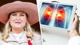 Die norwegische Kronprinzessin Mette-Marit hat aufgrund schwerer Lungenfibrose ein neues Organ ...