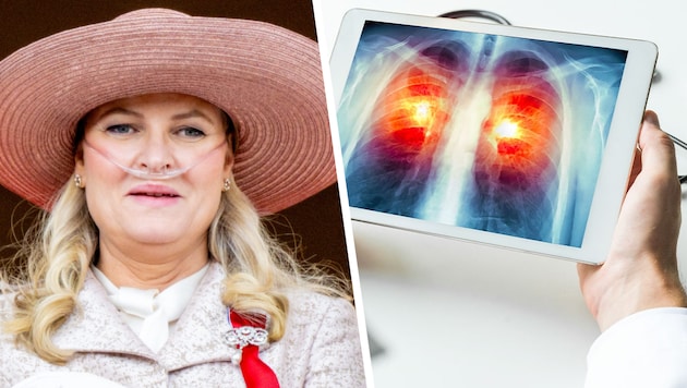 Die norwegische Kronprinzessin Mette-Marit hat aufgrund schwerer Lungenfibrose ein neues Organ ...