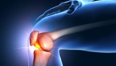 Das Knie muss gleichzeitig stark und beweglich sein. Deshalb ist es so anfällig für Probleme.