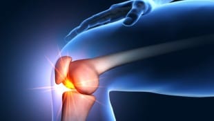 Das Knie muss gleichzeitig stark und beweglich sein. Deshalb ist es so anfällig für Probleme.
