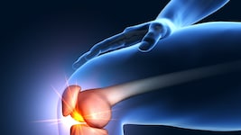 Das Knie muss gleichzeitig stark und beweglich sein. Deshalb ist es so anfällig für Probleme.