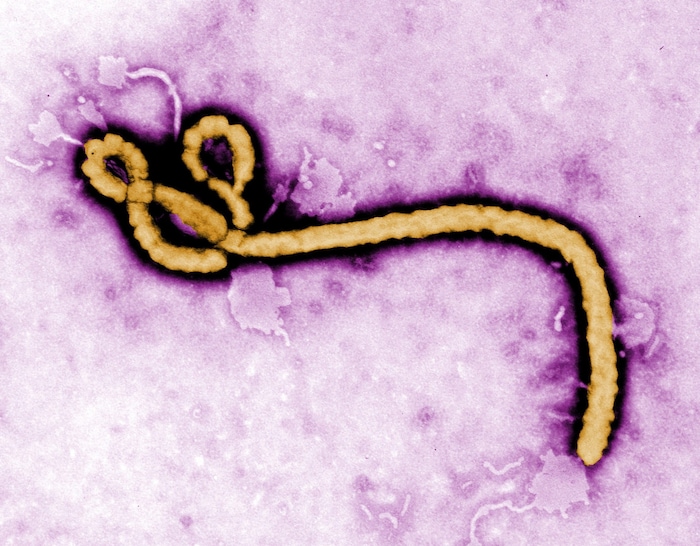 Diese eingefärbte Aufnahme eines Transmissionselektronenmikroskops zeigt den Ebola-Erreger.