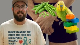 US-Amerikaner Michael Phillips leidet unter seinem kleinen besten Stück: Es ist so groß wie z. ...
