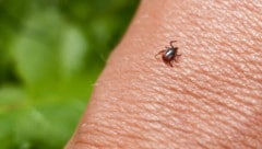 Zecken stechen derzeit häufig zu – auch im Ausland.