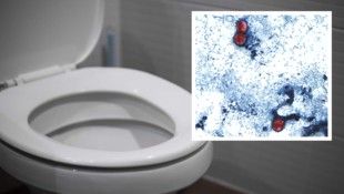 Der Parasit Cyclospora cayetanensis befällt den Dünndarm.