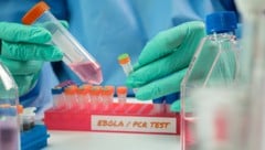 Ende Juni war das Bundibugyo-Virus erstmals in Europa nachgewiesen worden.