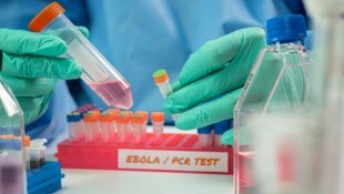 Ende Juni war das Bundibugyo-Virus erstmals in Europa nachgewiesen worden.