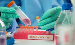 Ende Juni war das Bundibugyo-Virus erstmals in Europa nachgewiesen worden.